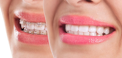 The image shows a person s face with two different lipstick shades applied on each side, creating a humorous contrast between the two.