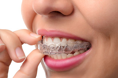 Woman holding toothpaste with braces on her teeth.