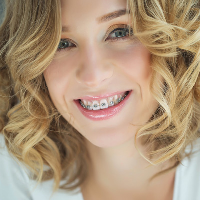 The image shows a smiling woman with straight teeth, wearing braces, against a light background.